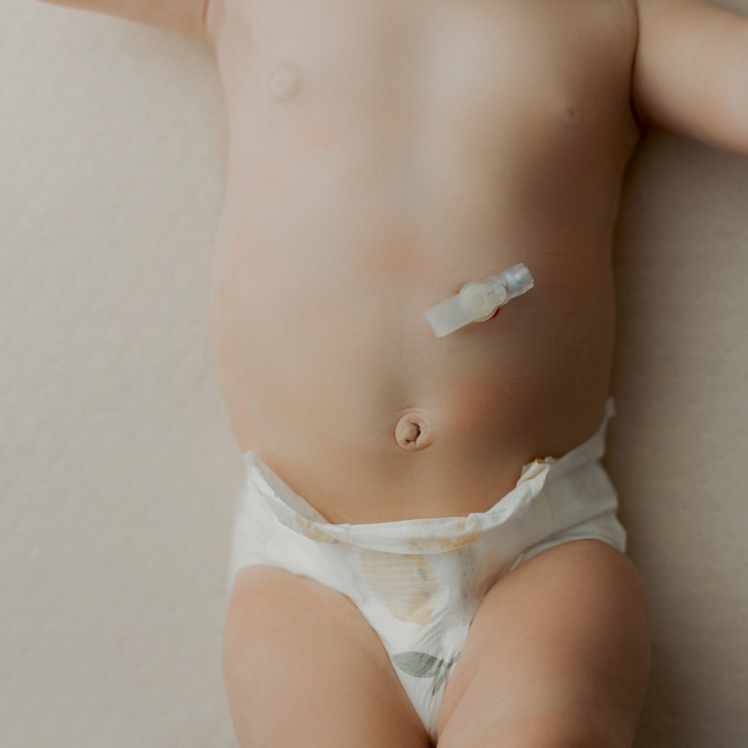 What is private duty nursing vs home health